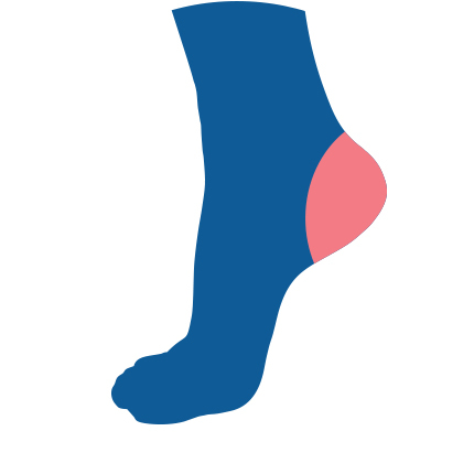 Icon for Achilles Tendonitis