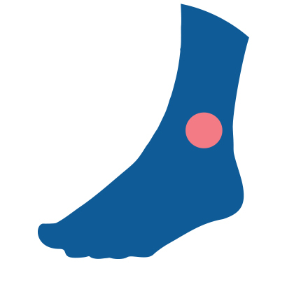 Icon for Ankle Sprains