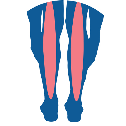 Icon for Sciatica