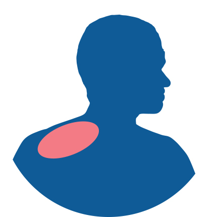 Icon for Shoulder Pain