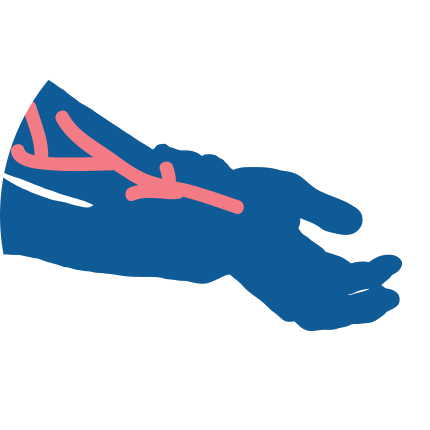 Icon for Trapped Nerves